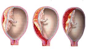 Nhau bong non - Hình ảnh minh họa